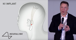 Elon Musk presenterar Neuralink och chippet N1
